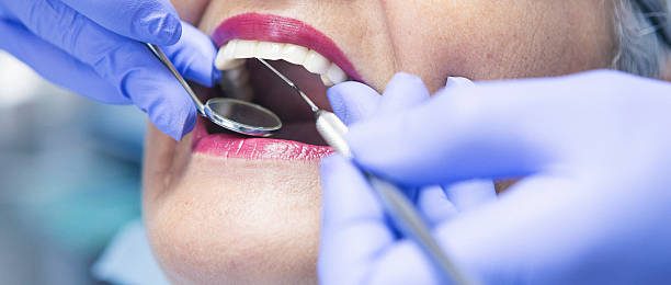 Best Emergency Cosmetic Dentistry (e.g., broken veneers) in Bellevue, IL